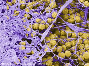 Scanning electron micrograph of stored pollen grains (yellow) and fungal growth (purple) resulting from air exposure and loss of protective effects of honey and bee salivary enzymes.
