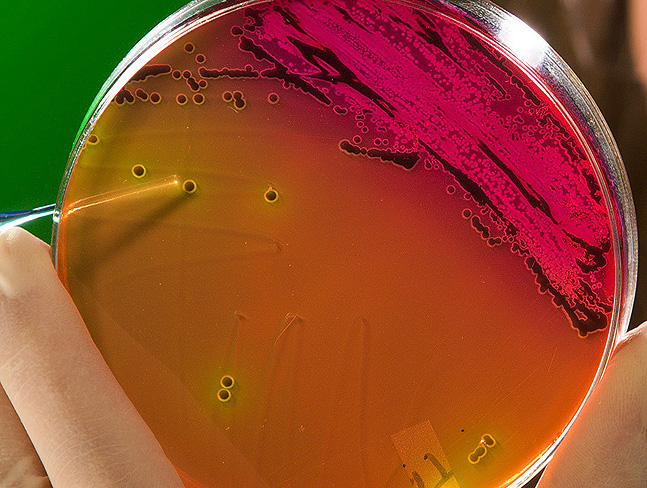 ARS is working with other government agencies to study bacteria in an interdisciplinary approach to mitigate antimicrobial resistance.